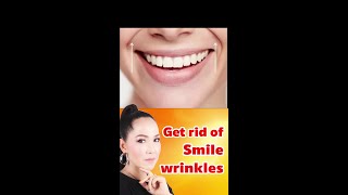 3 Mins Get Rid Smile Wrinkles, Laugh Lines, Nasolabial Folds Short Watch Full Video In Description