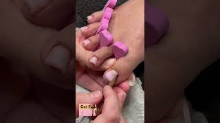 Toenail Growth Journey Tips for Healthy Nail Recovery!