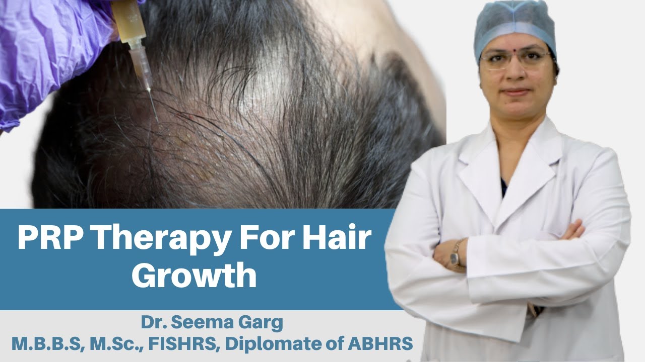 Aggregate 137+ hair fall treatment in indore