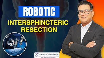 Robotic Intersphincteric Resection – Precision Surgery for Rectal Cancer #rectal #cancer