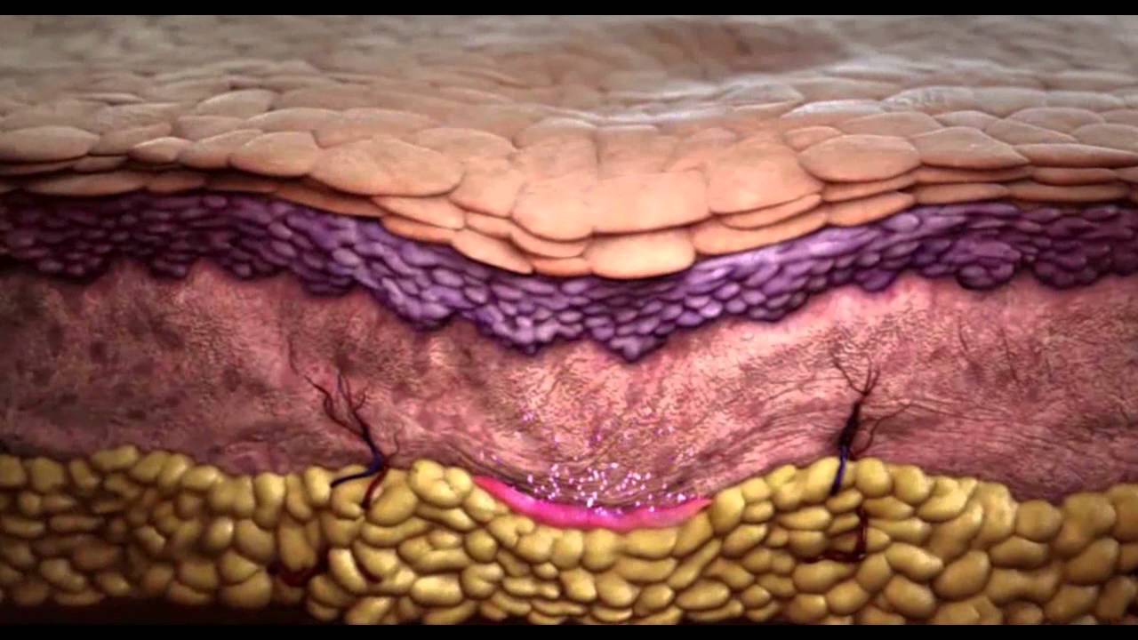 medical center country How Dermal Filler Sculptra Aesthetic Works, Replace Lost Collagen