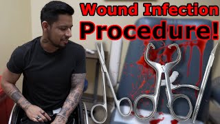 Emergency Procedure: My Intense Visit to the Wound Specialist!