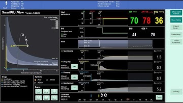 SmartPilot View  - Demo