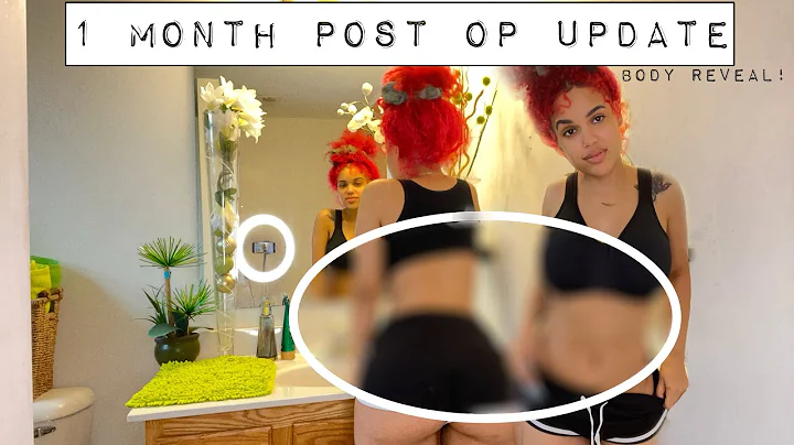 VLOGMAS DAY 6| 1 month post op surgery update (BRE...