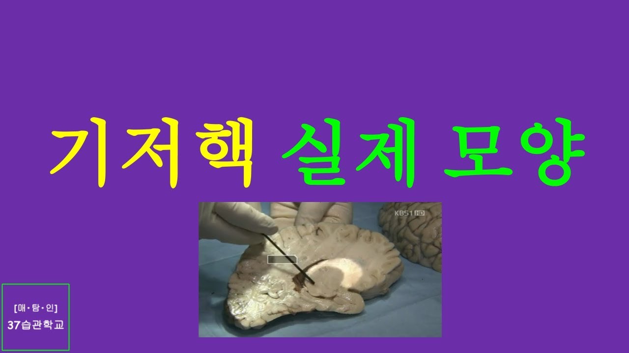 매탐인 기저핵 - 기저핵 실제 위치와 모양 - YouTube