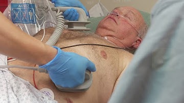 Manual Defibrillation with the HeartStart Intrepid monitor/defibrillator