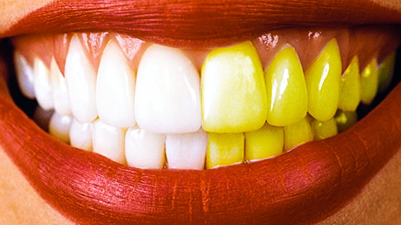 Зубы желтый чистить