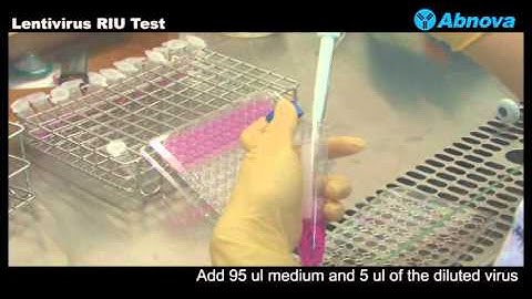 Lentivirus RIU Test