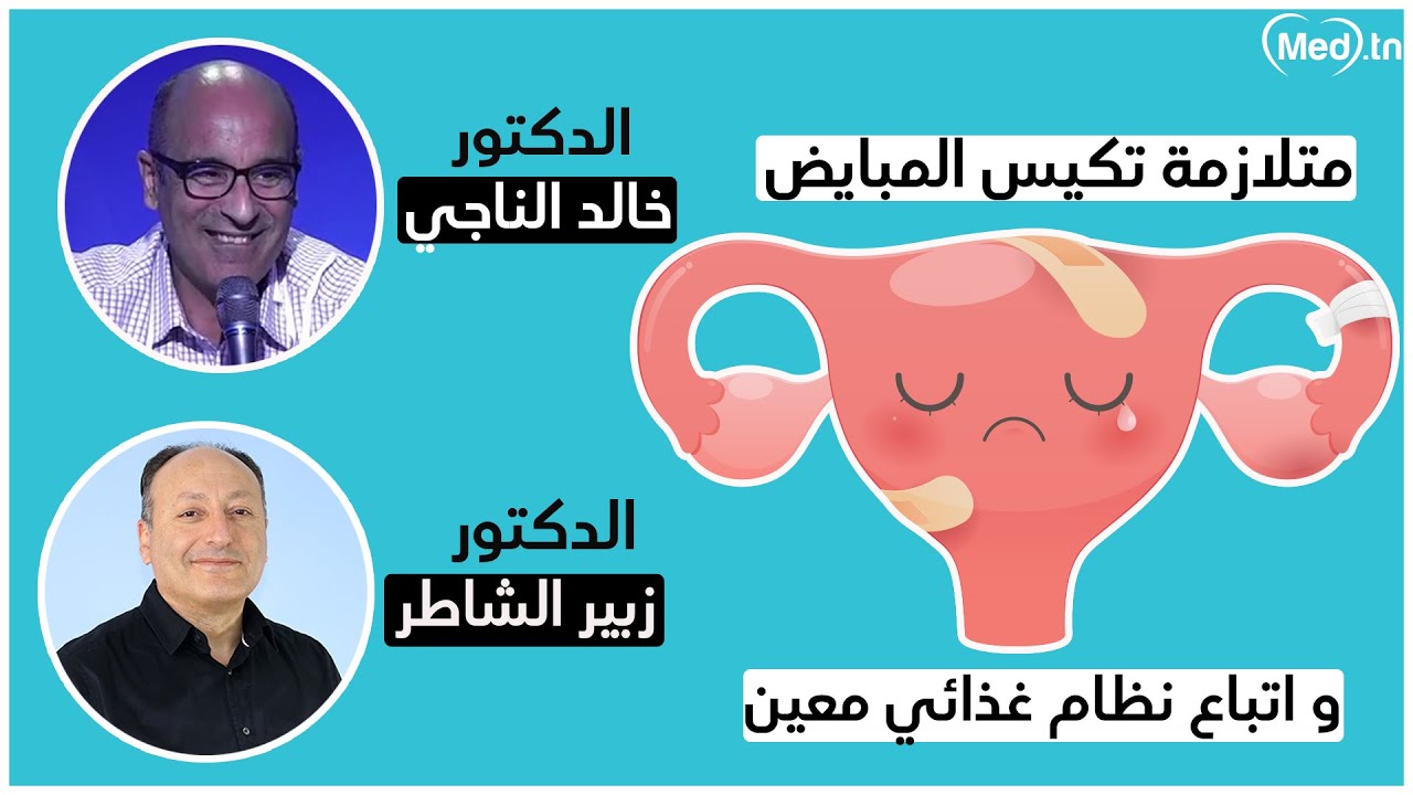 علاج متلازمة تكيس المبايض باتباع نظام غذائي معين| الدكتور خالد الناجي و الدكتور زبير الشاطر