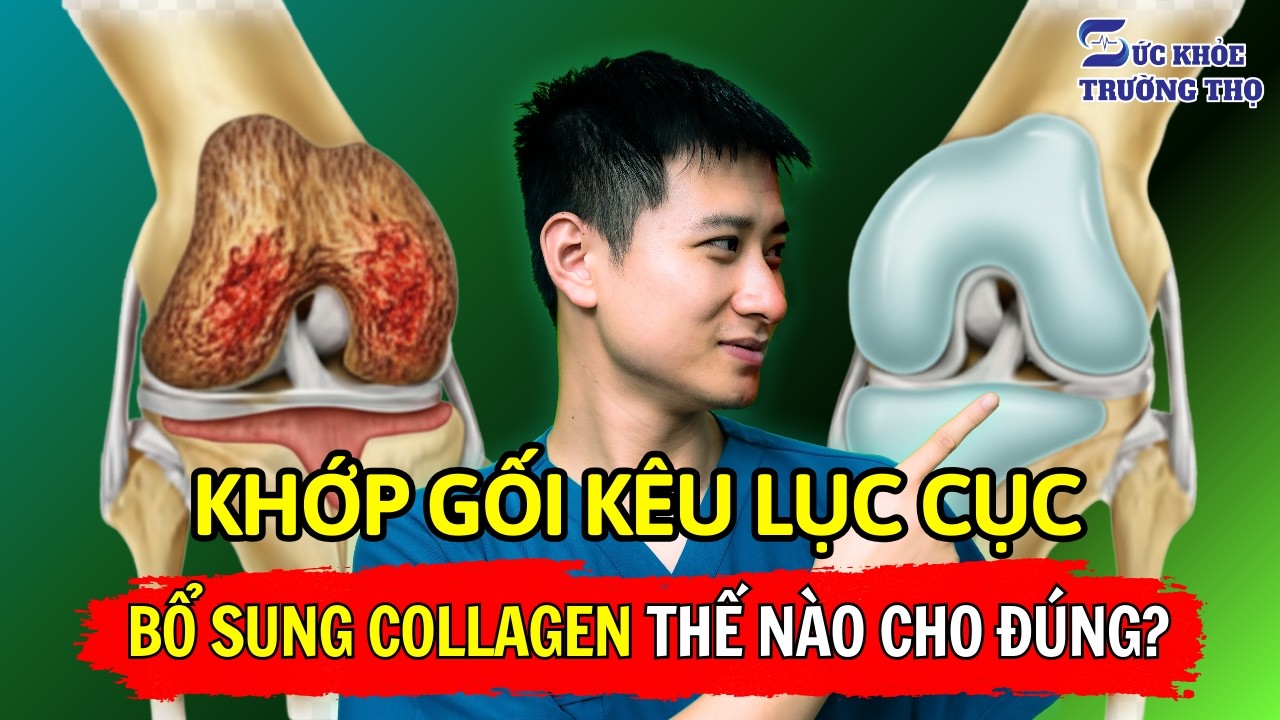 Giảm Đau Nhức Thoái Hóa Xương Khớp Nhờ Bổ Sung Collagen Đúng Cách