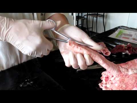 Video: Dissektera Lungutveckling Och Fibros Med Encellig Upplösning