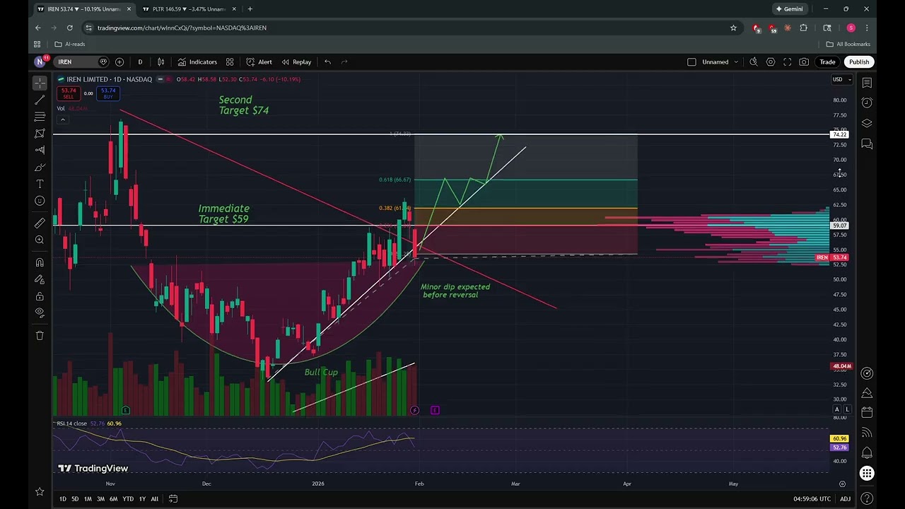 $IREN Is My Top AI Pick for Jan 2026. Bought the dip🚀📈