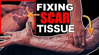 The Worst Painbreaking Down Scar Tissue If Youve Been Hurt You Need To Try This Lex Fitness