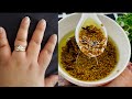 Intan Bes Ku Cayili Gacmaha Iyo Lugaha 1 Week Bes Remove Wrinkles From Hand And Feet At Home 
