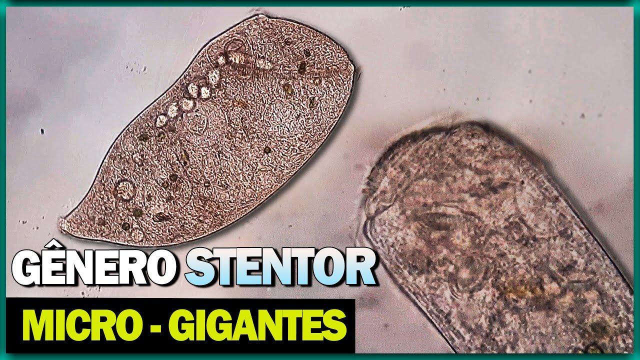 Esse protozoário é ENORME! Conheça o gênero Stentor.