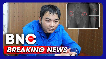 Cựu cán bộ y tế lừa đảo, đục xương khớp để rút ruột quỹ bảo hiểm | BNC Now