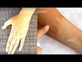 1 DAY SKIN WHITENING REMEDY (100% WORKS) GET RID OFF SUN TAN INSTANTLY NaturalHomeRemedies