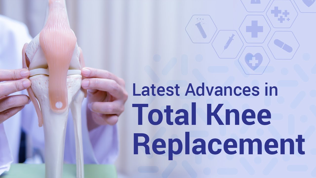 Latest Advances in Total Knee Replacement YouTube