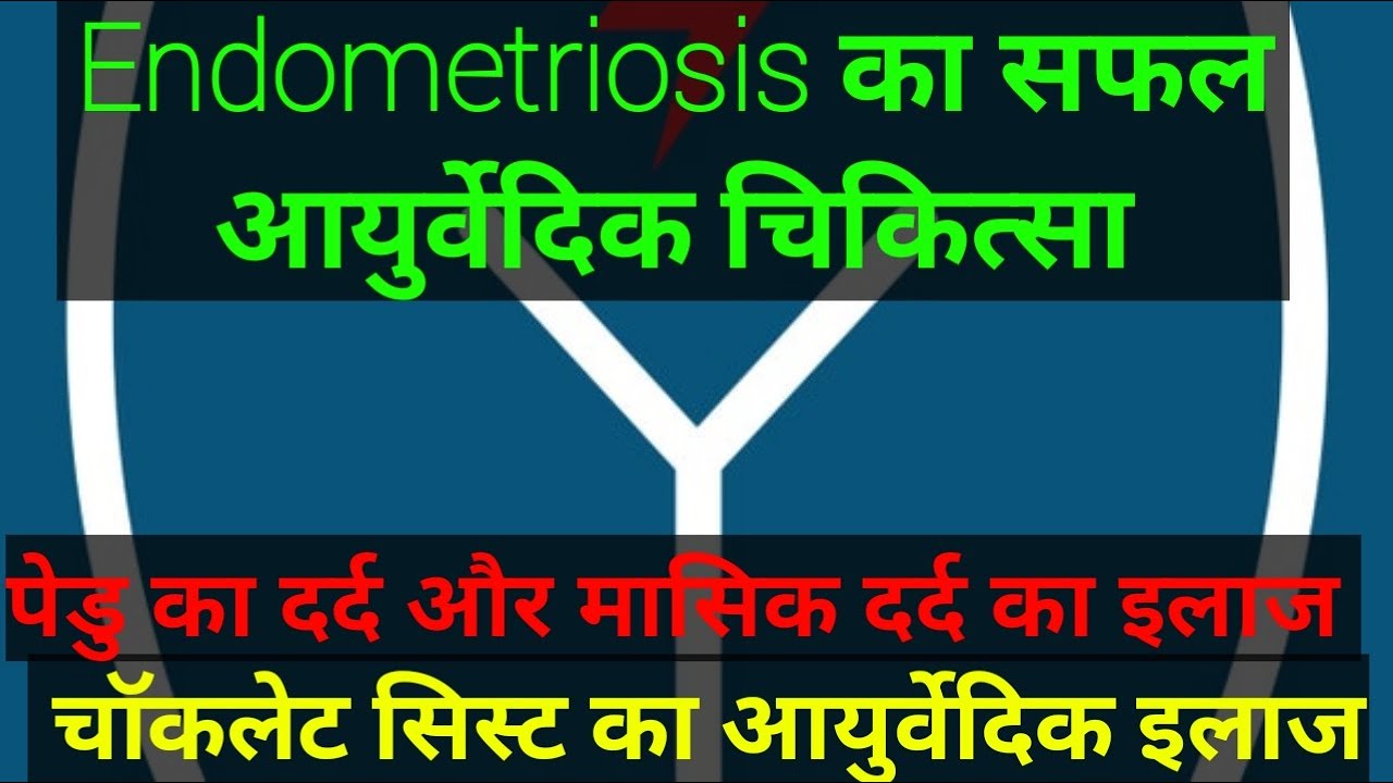 Chocolate cyst ka Ayurvedic ilaj. Endometriosis ka Ayurvedic ilaj