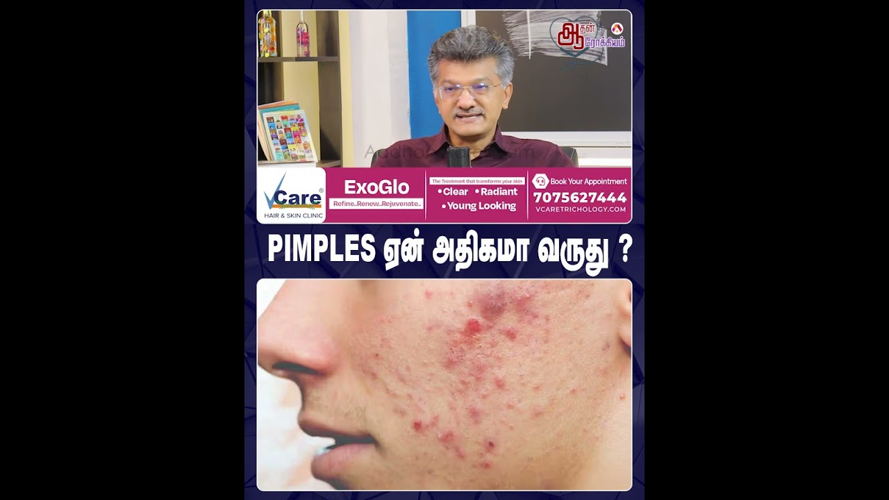 PIMPLES ஏன் அதிகமா வருது 