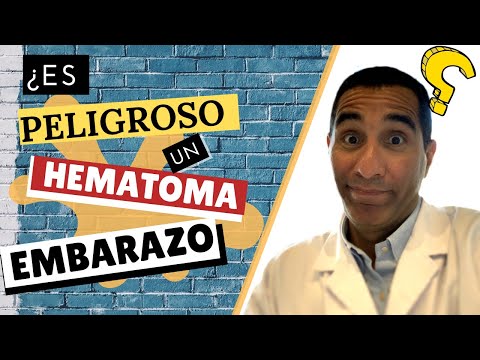 Vídeo: L'hemorràgia subcoriònica provoca calambres?