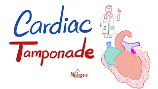 Cardiac Tamponade - Causes, Symptoms, Signs, Diagnosis & Treatment - Cardiology Series