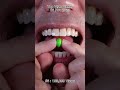 Satisfying Chewing ASMR #Compilation #ASMR #DoctorTristanPeh