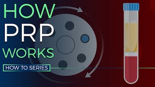 How PRP Works - HOW TO SERIES