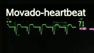 Movado-Heartbeat Lyrics
