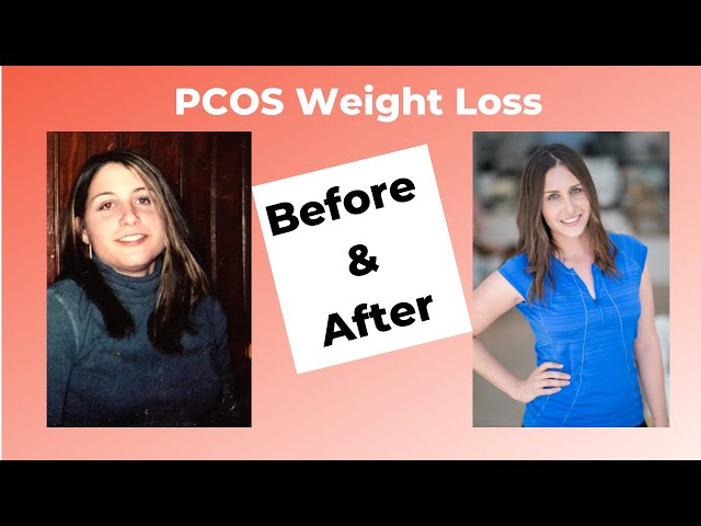 Pcos Weight Loss Before And After You