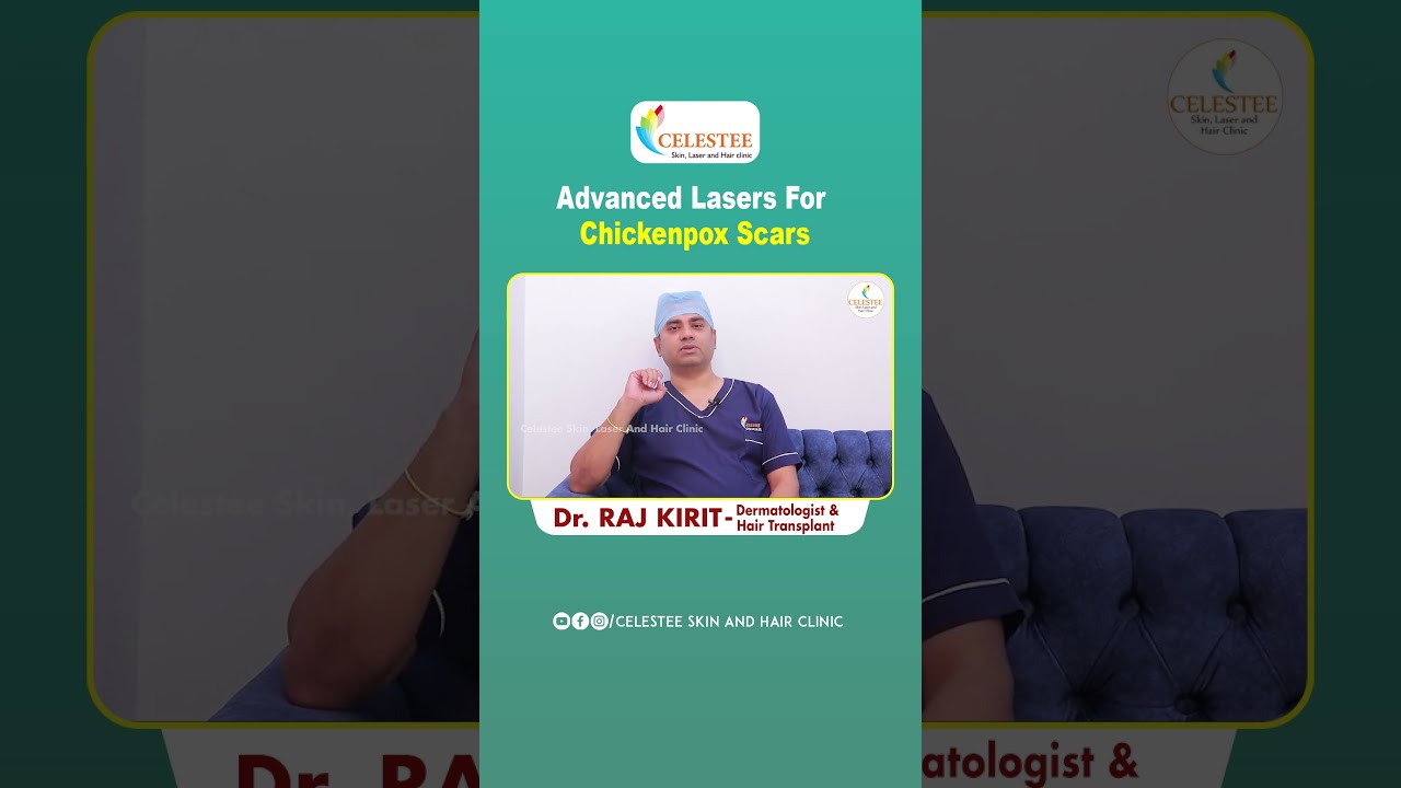 Advanced Laser Treatment For Chickenpox Scars || Celestee Skin And Hair Clinic #telugushorts #laser