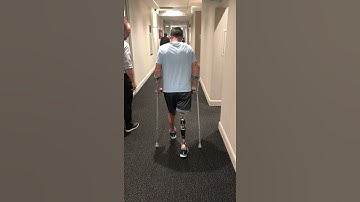 Above knee amputation with osseointegration