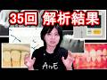 35回DH国家試験 解析しました！
