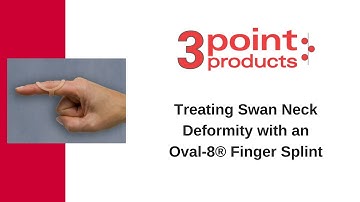 How to Treat Swan Neck Deformity with an Oval-8 Finger Splint - 3-Point Products
