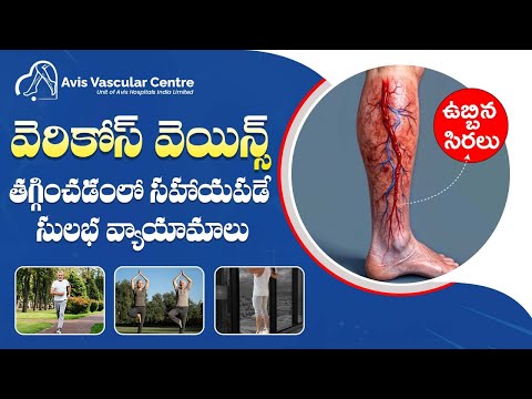 Best Exercises to Improve Vein Health | Dr Rajah V Koppala | Avis Hospital