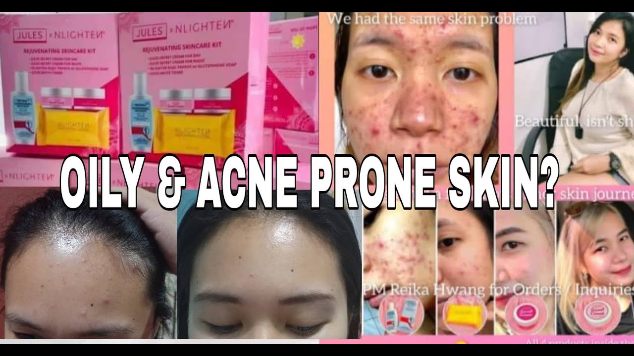 OILY ACNE PRONE SKIN TREATMENT REJUVENATING SKINCARE KIT YouTube