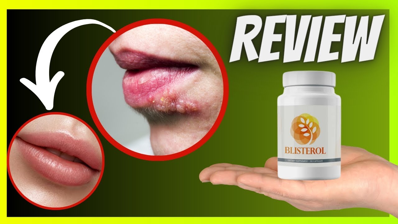 Unlocking Freedom:❌🔥 Blisterol Reviews ❌🔥- Your Natural Cure for Herpes Labialis Revealed!