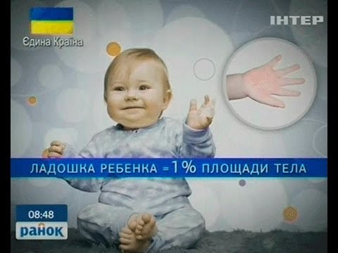 Термические Ожоги Малыша Ранок Інтер