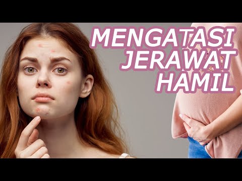 Video: Jerawat Saat Hamil. Penyebab Dan Cara Pengobatan