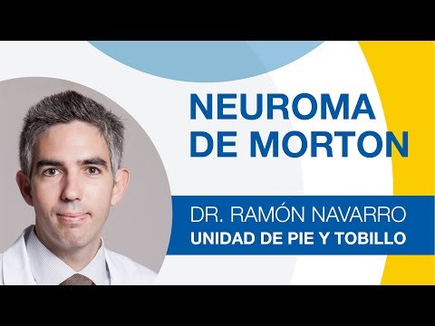 Video: Cómo tratar el neuroma de Morton y qué es