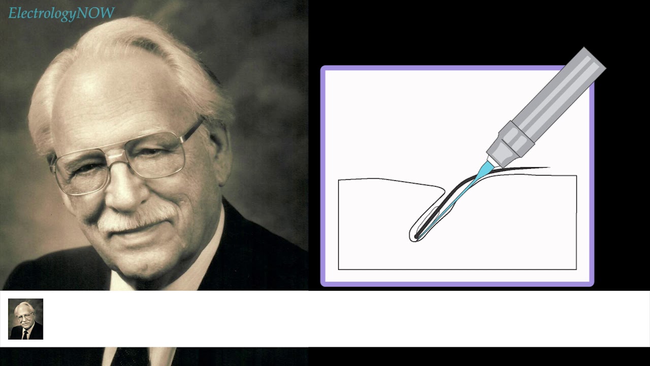Хинкель: Советы и вредные привычки