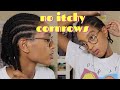 How I stop my cornrows/braids from itching