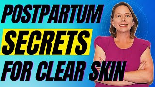 Clear Skin After Pregnancy: Ultimate Guide to Preventing, Controlling, and Treating Postpartum Acne