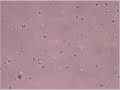 My spermatozoon