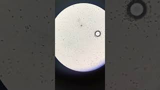 Sperm cells under a bright field microscope.