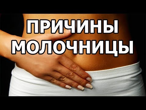 Причины возникновения молочницы у женщин | Почему появляется молочница у девушек