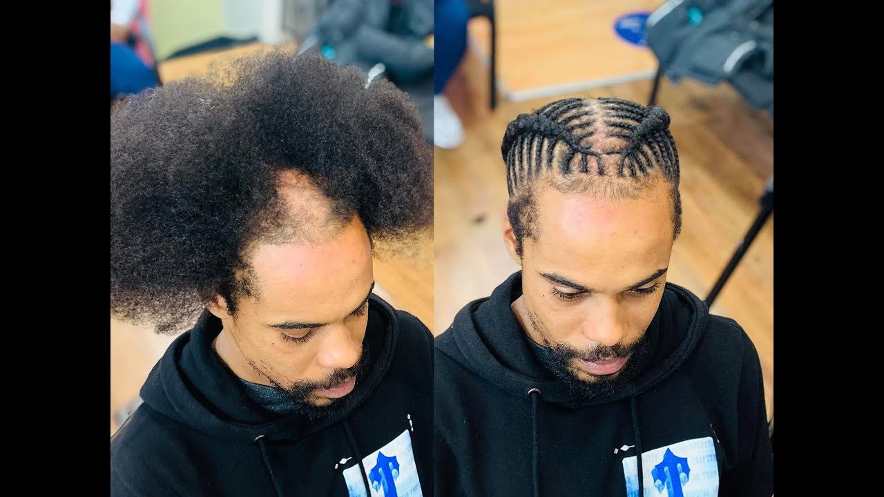 How Long Do It Take A Bald Spot To Grow Back
