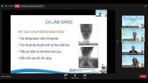 Đột quỵ sau can thiệp động mạch vành qua da: Trường hợp lâm sàng