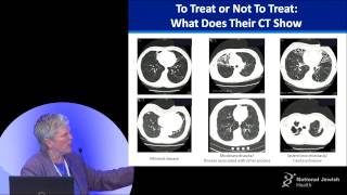 Gwen Huitt, MD  To treat or not to treat  that is the question