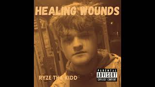 Ryze Tha Kidd - Scars (ft. Emilyn) (Nightcore) [Official Audio]